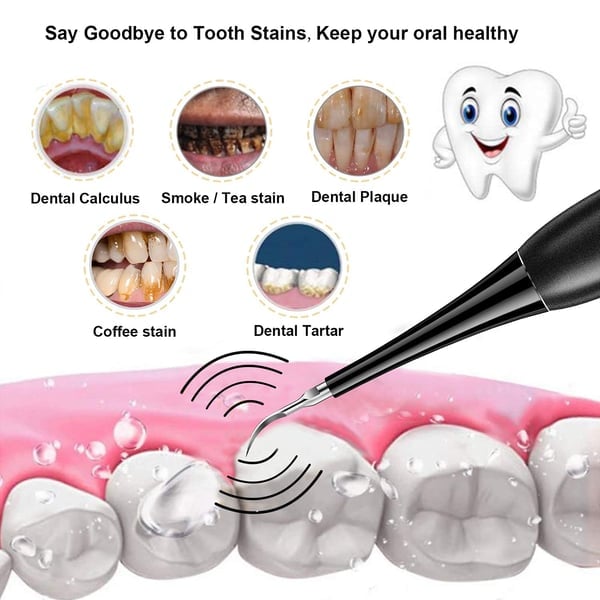 Electric Teeth Cleaner