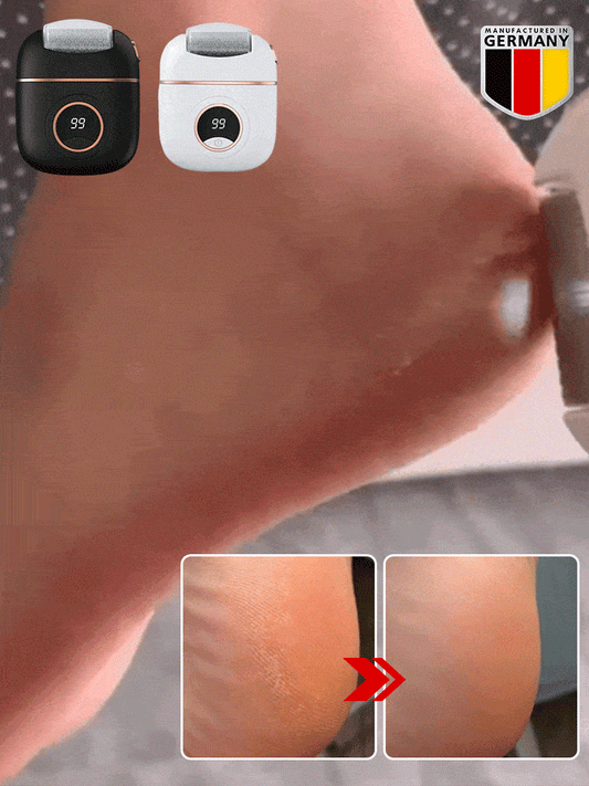 Digital Electric Foot Polisher