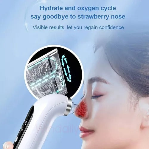 Blackhead Remover Device