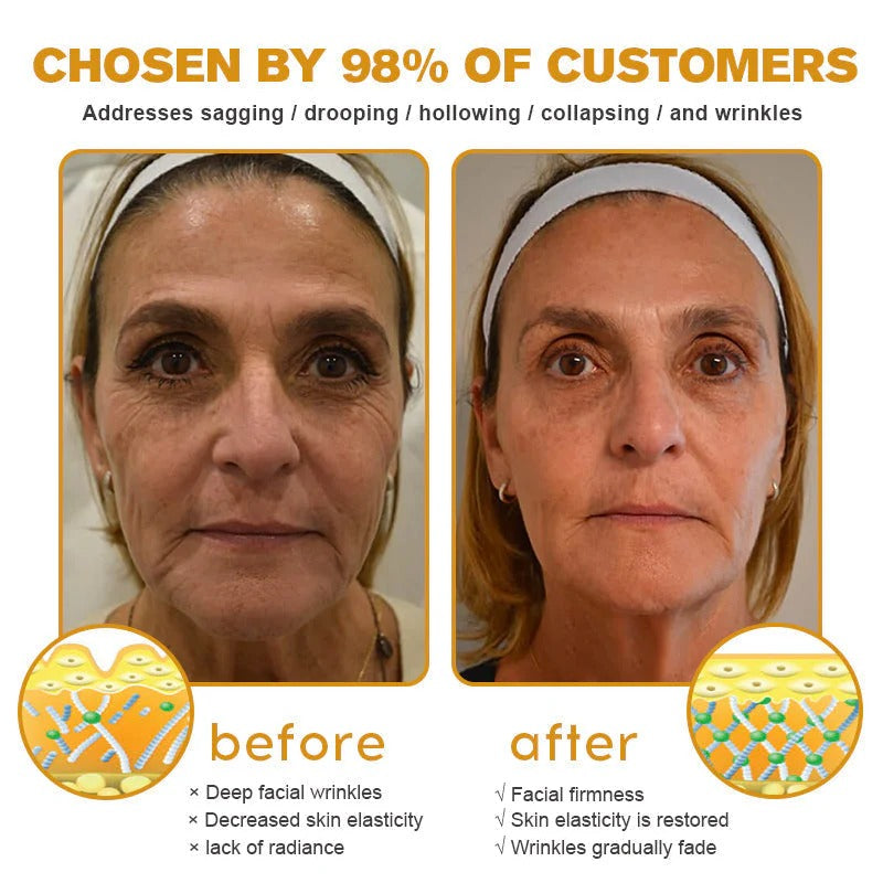 Erase Wrinkles Naturally – for Men & Women TK